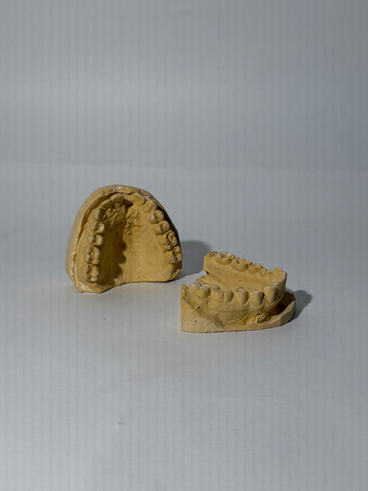 Clay Dental Mold