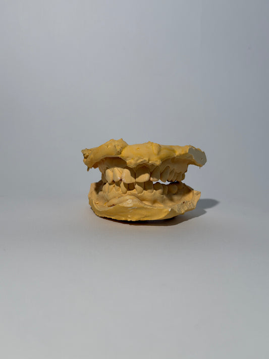 Clay Dental Mold 2